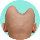BALD icon